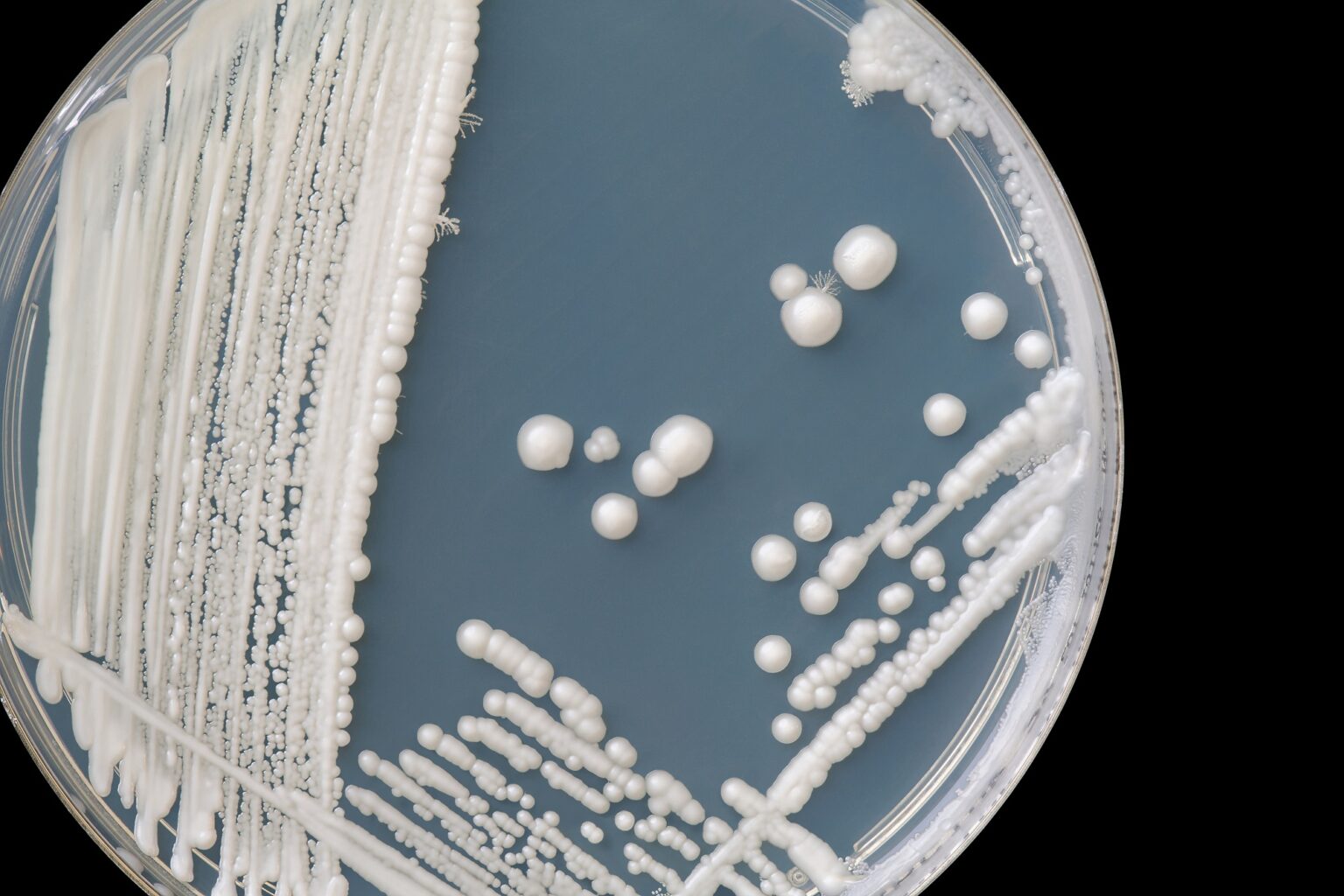 a microscopic view of candida albicans fungi in Columbus Ohio