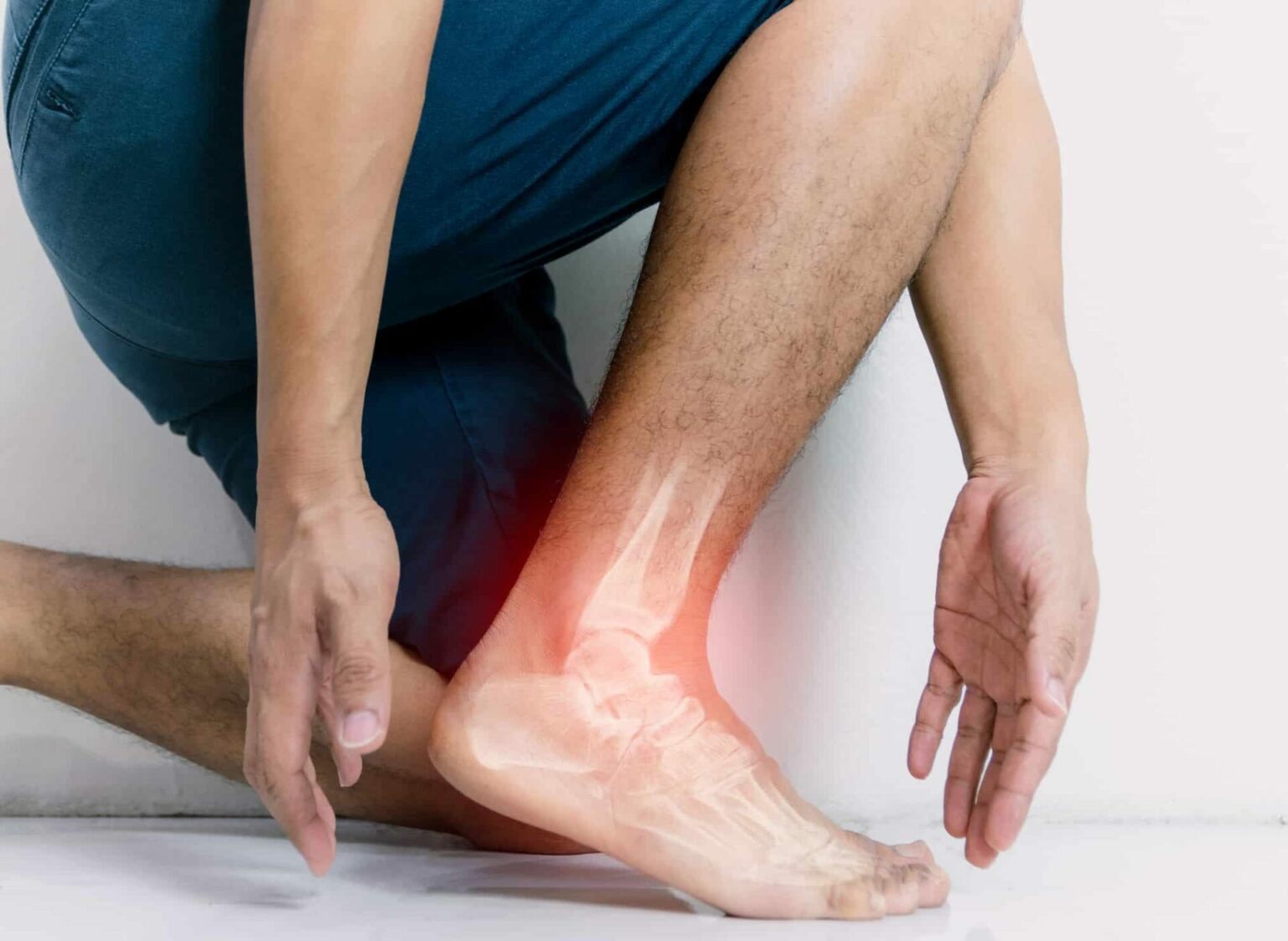 a foot with joint inflammation