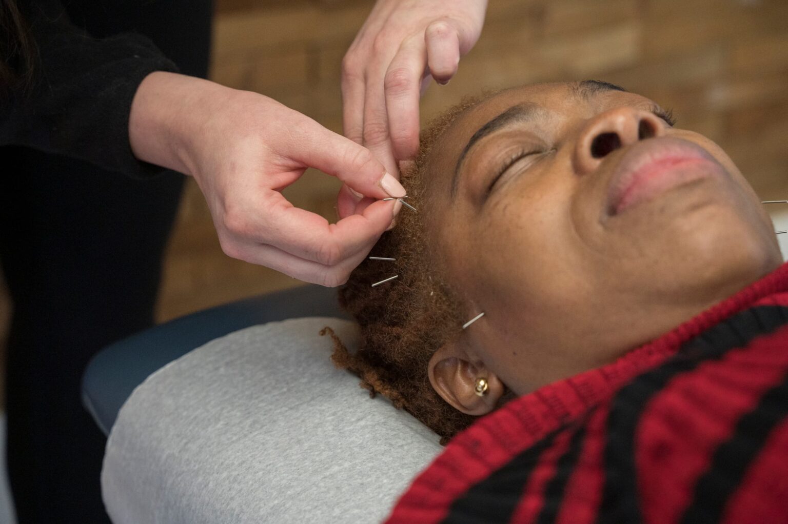 a female patient undergoing dry needling therapy from Active Edge in Columbus Ohio