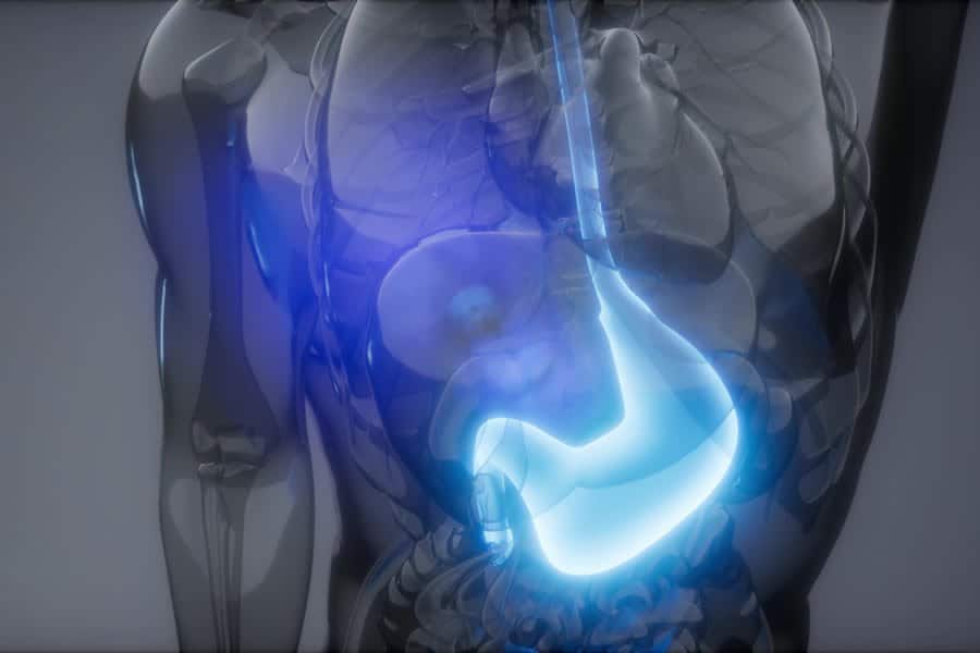 an illustration showing Gut Dysbiosis in the stomach